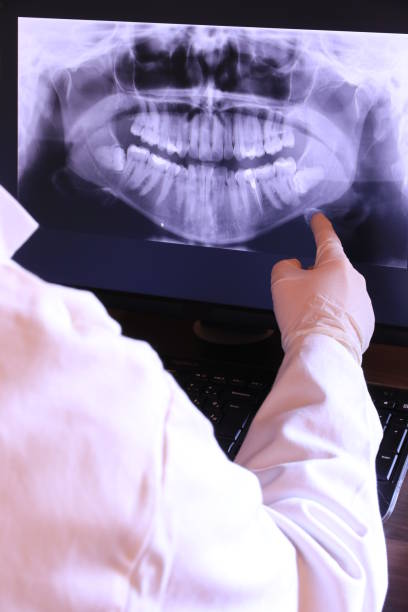 Best Emergency Treatment for Toothache in Ville Ptte, LA