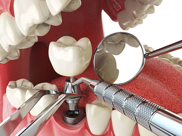  Ville Ptte, LA Emergency Dentist Pros